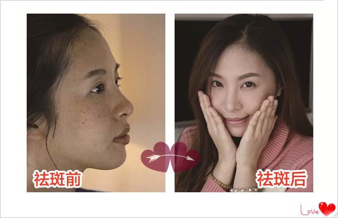 最新眼保健操视频，点亮双眸，启程自信梦想之旅